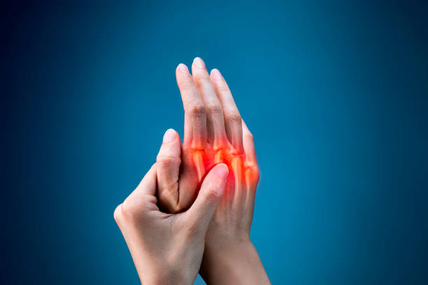 Rheumatoid Arthritis Ayurvedic Treatment image